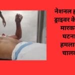 नेशनल हाईवे में ट्रक ड्राइवर के साथ चाकू मारकर लूट की घटना अज्ञात हमलावर फरार चालक गंभीर