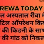 नेशनल अस्पताल रीवा में एक और जटिल ऑपरेशन किया गया, मरीज की किडनी के साथ बनी कैंसर की गांठ को निकल गया