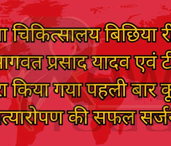 जिला चिकित्सालय बिछिया रीवा में डॉ भागवत प्रसाद यादव एवं टीम के द्वारा किया गया पहली बार कूल्हा प्रत्यारोपण की सफल सर्जरी