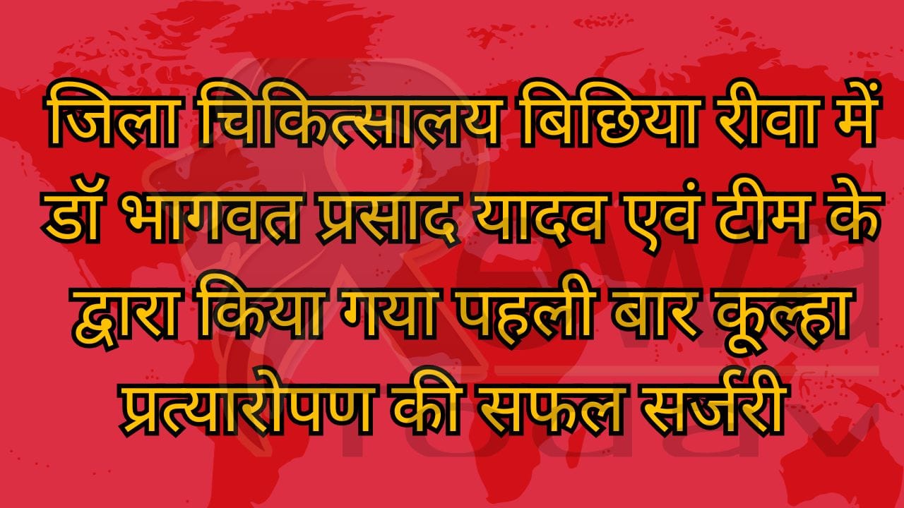जिला चिकित्सालय बिछिया रीवा में डॉ भागवत प्रसाद यादव एवं टीम के द्वारा किया गया पहली बार कूल्हा प्रत्यारोपण की सफल सर्जरी